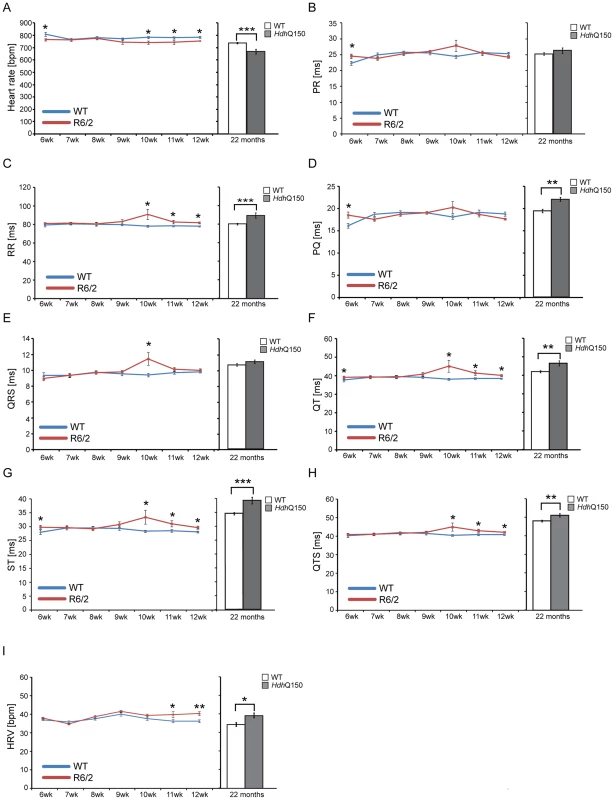 Resting ECG measurements for R6/2 and <i>Hdh</i>Q150 mice.