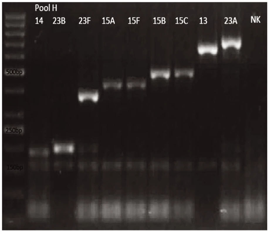 mPCR pool H
Dráha 1: 50bp DNA Ladder
Dráha 2: <i>S. pneumoniae</i> sérotyp 14 (189bp)
Dráha 3: S<i>S. pneumoniae</i> sérotyp 23B (199bp)
Dráha 4: <i>S. pneumoniae</i> sérotyp 23F (384bp)
Dráha 5: <i>S. pneumoniae</i> sérotyp 15A (434bp)
Dráha 6: <i>S. pneumoniae</i> sérotyp 15F (434bp)
Dráha 7: <i>S. pneumoniae</i> sérotyp 15B (496bp)
Dráha 8: <i>S. pneumoniae</i> sérotyp 15C (496bp)
Dráha 9: <i>S. pneumoniae</i> sérotyp 13 (655bp)
Dráha 10: S. pneumoniae sérotyp 23A (722bp)
Dráha 11: negativní kontrola
Dráha 2–10: pozitivní produkt cpsA (160bp)<br>
Fig. 8. mPCR pool H
Lane 1: 50bp DNA Ladder
Lane 2: <i>S. pneumoniae</i> serotype 14 (189bp)
Lane 3: <i>S. pneumoniae</i> serotype 23B (199bp)
Lane 4: <i>S. pneumoniae</i> serotype 23F (384bp)
Lane 5: <i>S. pneumoniae</i> serotype 15A (434bp)
Lane 6: <i>S. pneumoniae</i> serotype 15F (434bp)
Lane 7: <i>S. pneumoniae</i> serotype 15B (496bp)
Lane 8: <i>S. pneumoniae</i> serotype 15C (496bp)
Lane 9: <i>S. pneumoniae</i> serotype 13 (655bp)
Lane 10: <i>S. pneumoniae</i> serotype 23A (722bp)
Lane 11: negative control
Lanes 2–10: positive product cpsA (160bp)