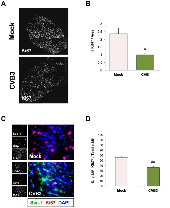 Juvenile CVB3 infection triggered growth arrest in CPCs.