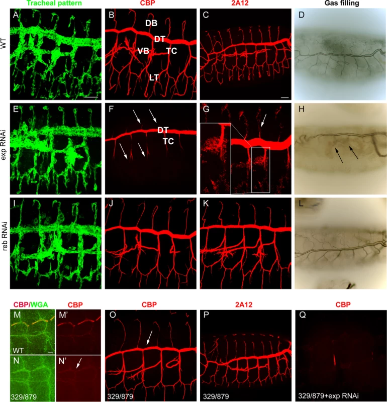 Tracheal defects in <i>exp</i> and <i>reb</i> loss-of-function.