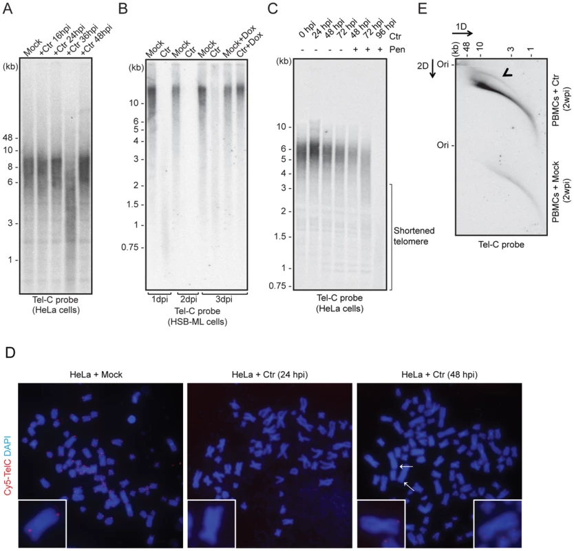 <i>C. trachomatis</i> (Ctr) infection induces telomere alterations.