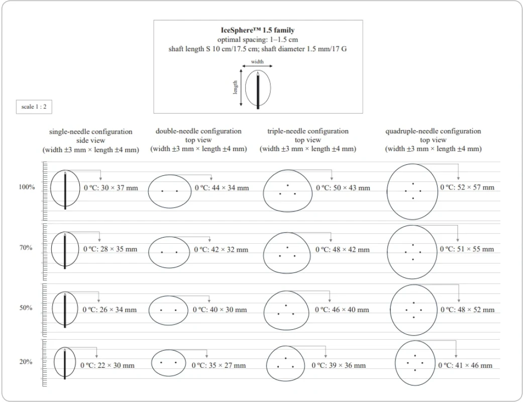 Authors’ graphical representation at a 1 : 2 scale of the ice balls generated during the experimental sessions using single and multiple (double, triple, and quadruple) IceSphere™ needle confi gurations at different freezing intensities (100%, 70%, 50%, and 20%). Data were obtained in gel at room temperature after a single 10-minute freezing cycle.