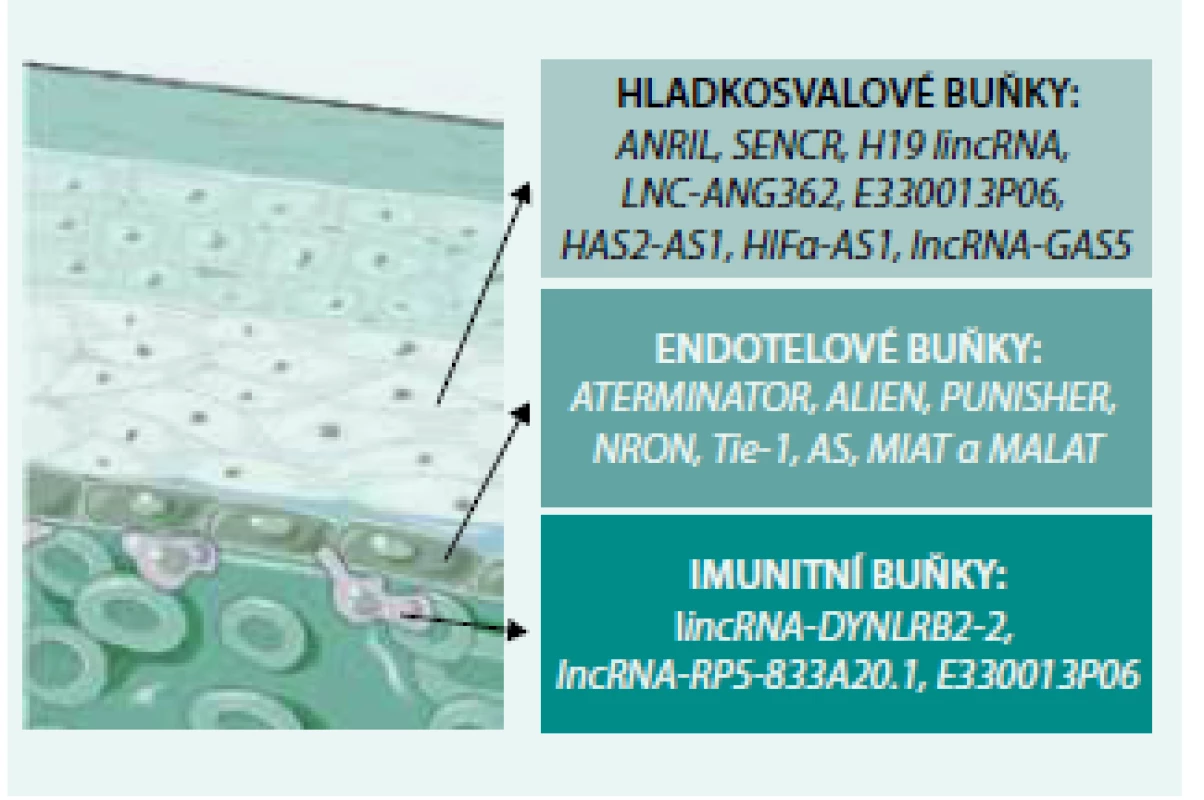 Přehled vybraných lncRNA a jejich zapojení do patofyziologie aterosklerózy
Levá část obrázku znázorňuje řez cévní stěnou s červenými krvinkami nejvíce dole, vrstvou endotelií a vrstvou hladkosvalových buněk. Jednotlivá textová pole poté shrnují názvy lncRNA,
které v daném buněčném typu participují na procesu aterosklerózy. Obrázek vytvořen s pomocí Servier Medical Art (volně dostupné na http://smart.servier.com/)