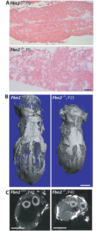 Muscle and fat in <i>Fbn2</i> null mice on a C57/Bl6 background.