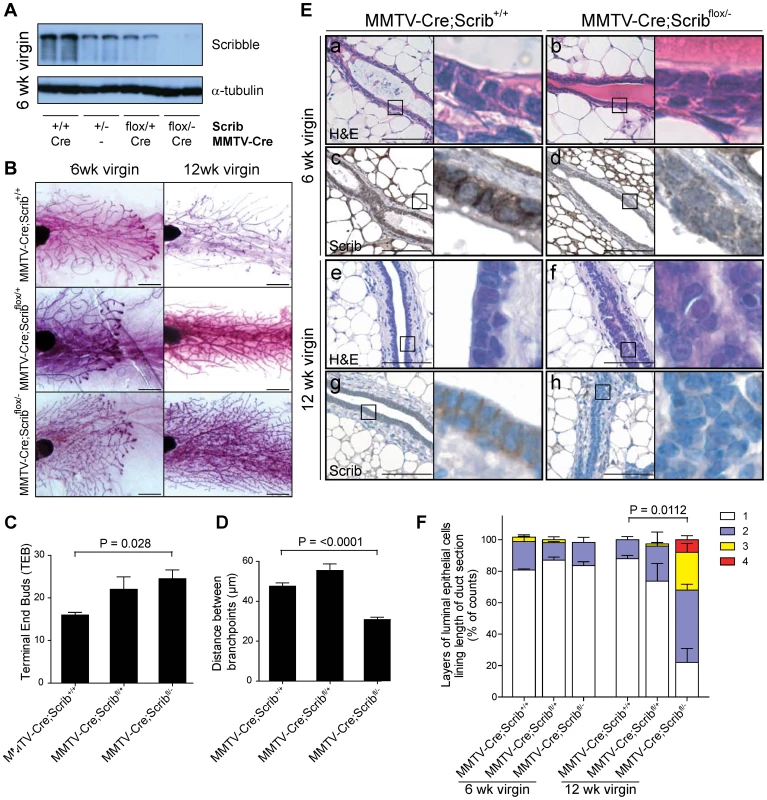 <i>Scrib</i> loss in the mammary gland results in duct hyperplasia.