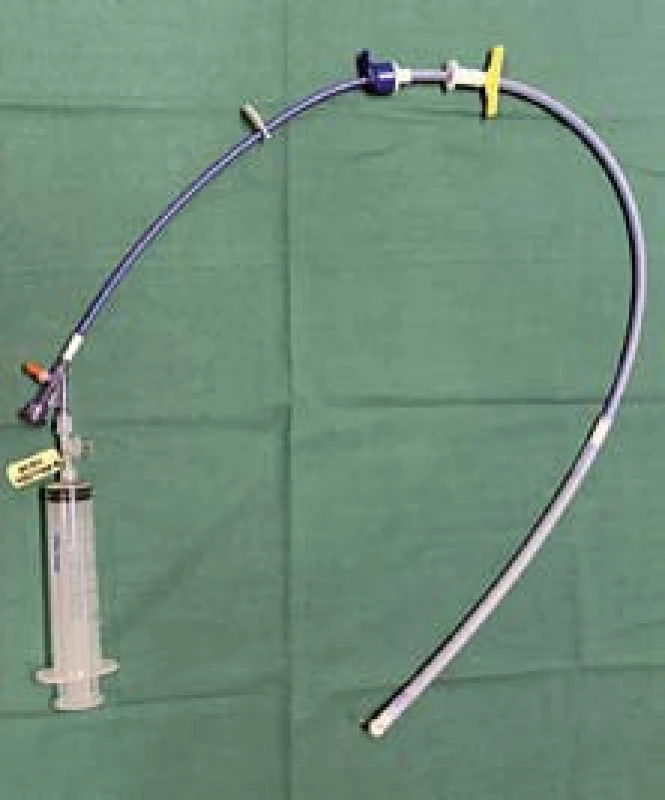 Stent připravený k zavedení v zavaděči (připravená stříkačka k insuflaci balonku).
Fig. 3. Stent prepared for application in an applicator (prepared syringe for balloon insufflation).