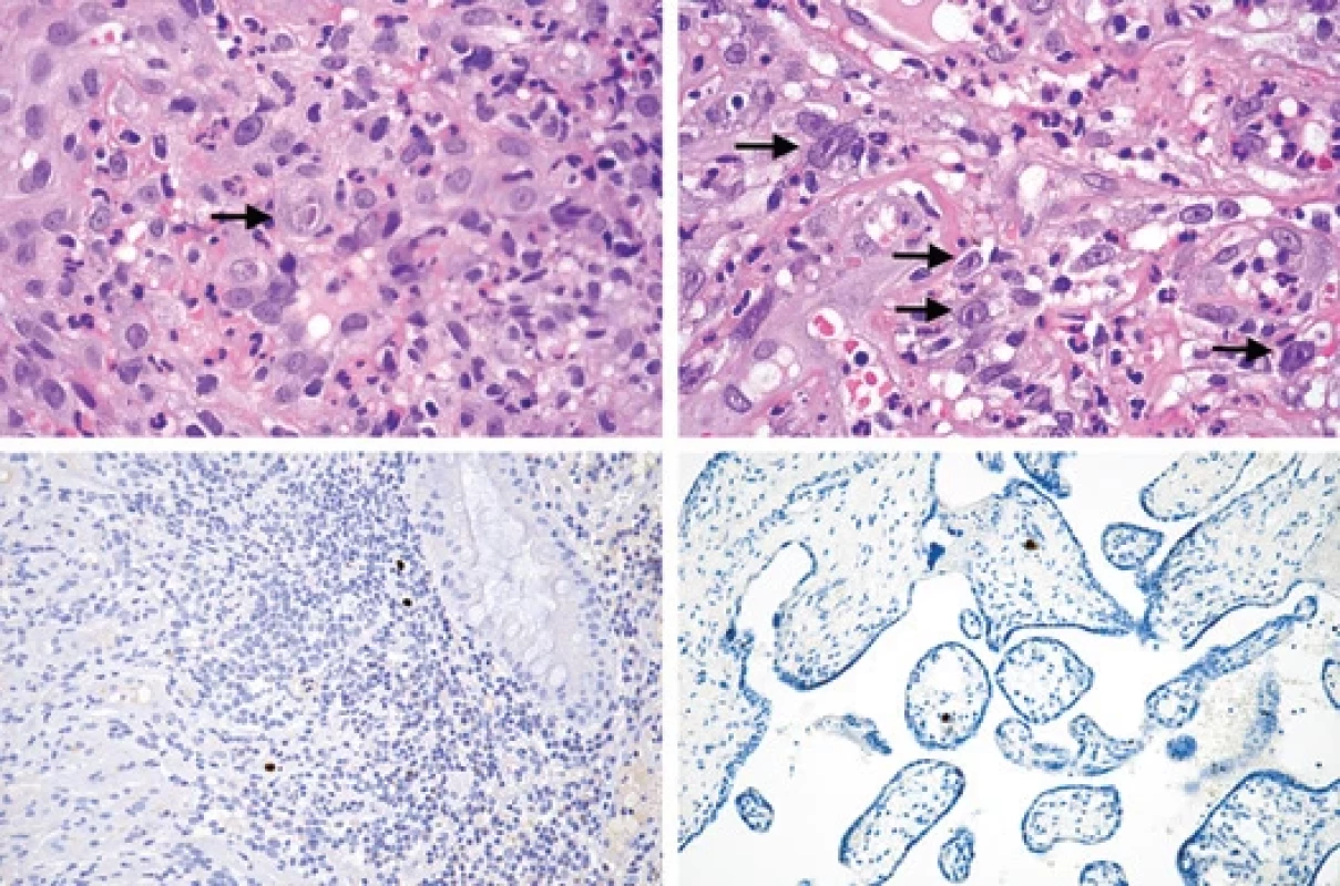 Imunohistochemické barvení FFPE preparátů.
