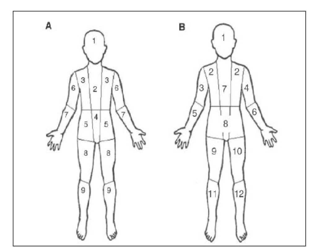 Skórovací systémy Curie a SIOPEN
A – semikvantitativní skórovací systém Curie, 9 skeletárních segmentů, samostatný 10. segment tvoří měkké tkáně.
B – semikvantitativní skórovací systém SIOPEN, 12 skeletárních segmentů, měkké tkáně se nehodnotí. Každý systém má samostatnou skórovací škálu, u metody Curie se hodnotí i intenzita akumulace radiofarmaka.