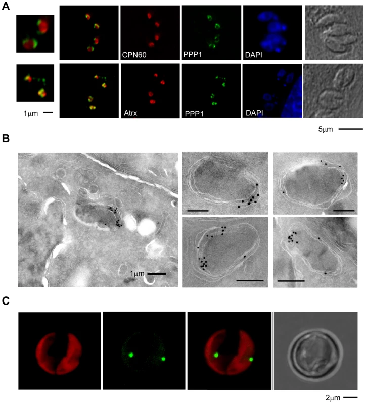 PPP1 is a resident of the apicoplast periphery and most likely the periplastid compartment.