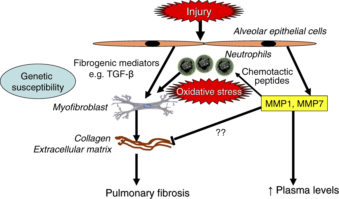 Mechanisms of IPF
