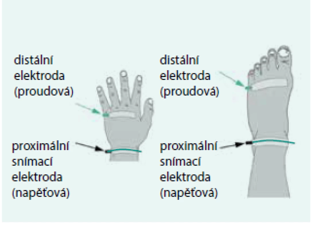 Umístění elektrod ve 4elektrodovém uspořádání při celotělovém BIA měření