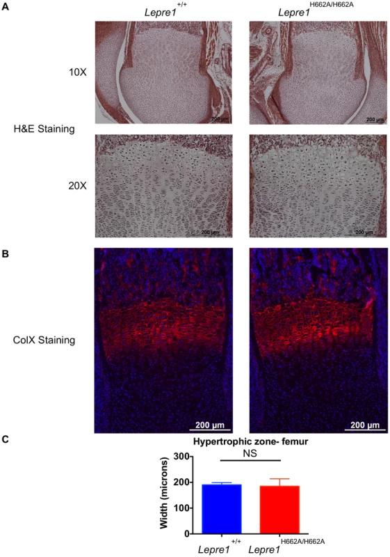 <i>Lepre1<sup>H662A/H662A</sup></i> mice have a normal femoral hypertrophic zone.