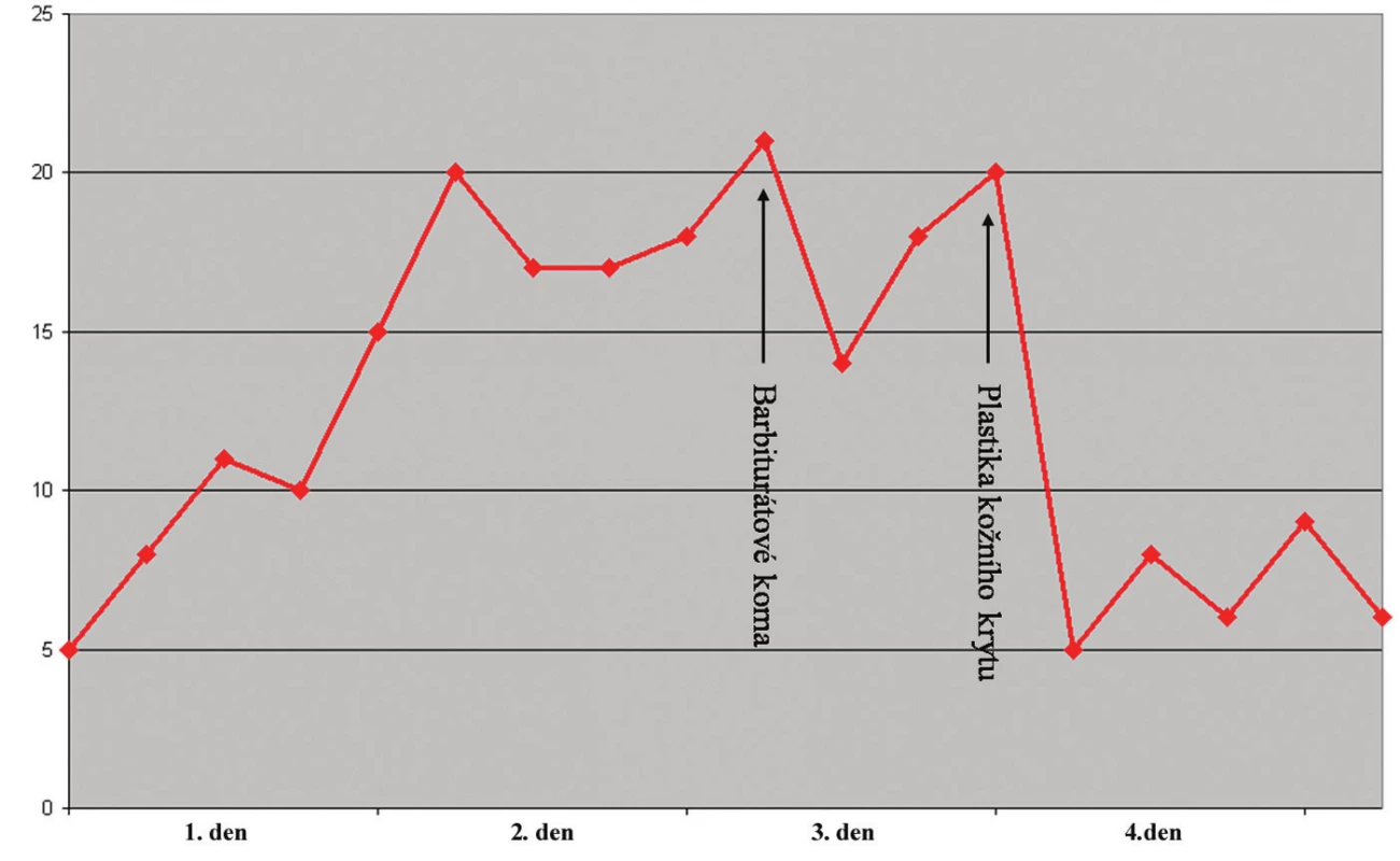 Graf se záznamem hodnot nitrolebního tlaku. Hodnoty tlaku jsou v mm Hg
Fig. 4. Graph of the recorded intracranial pressure values in mm Hg
