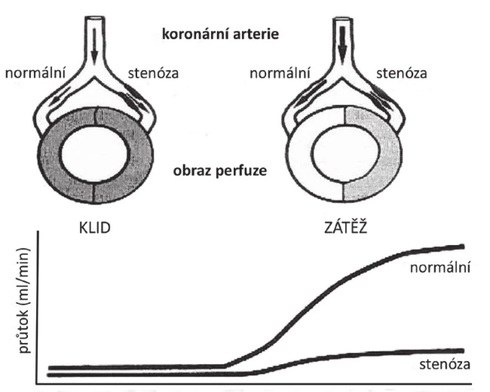 Schéma reakce koronárních cév na zátěž (nahoře) a průtoku krve cévami (dole).