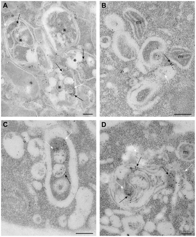 Complex membranous compartments containing both tombusvirus VRCs and the ESCRT protein Vps4p fused with MT and HA tags in yeast.