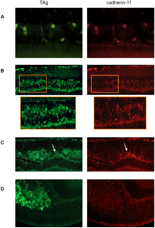 Gradual loss of cadherin-11 expression in TAg-RB tumors.