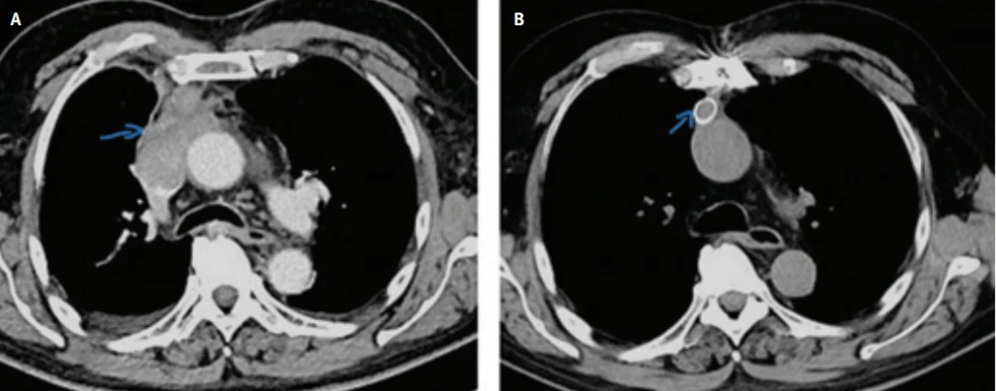  / Fig. 6.