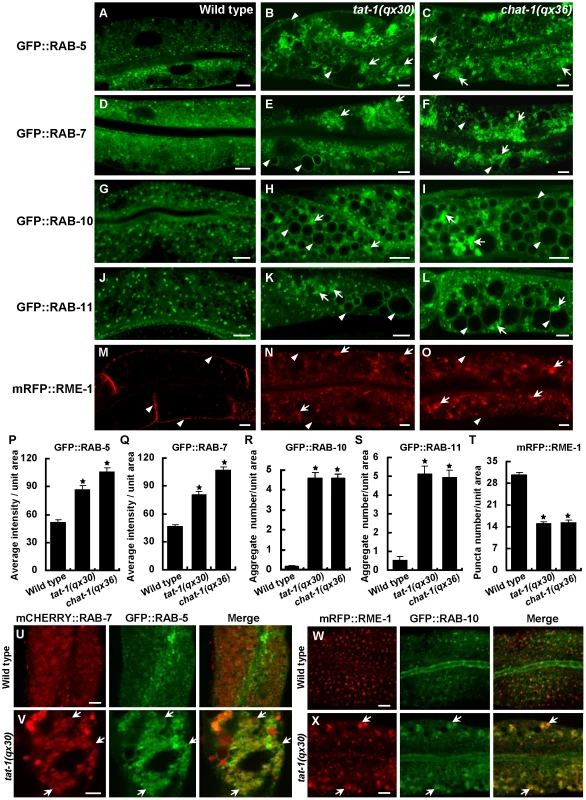 Various endocytic compartments are defective in <i>tat-1</i> and <i>chat-1</i> mutants.