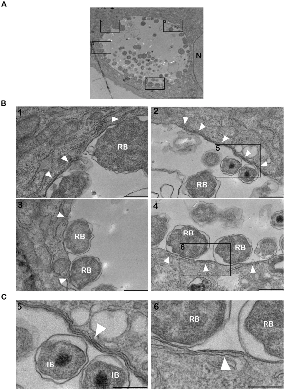 ER tubules are in close apposition with <i>C. trachomatis</i> inclusion membrane.