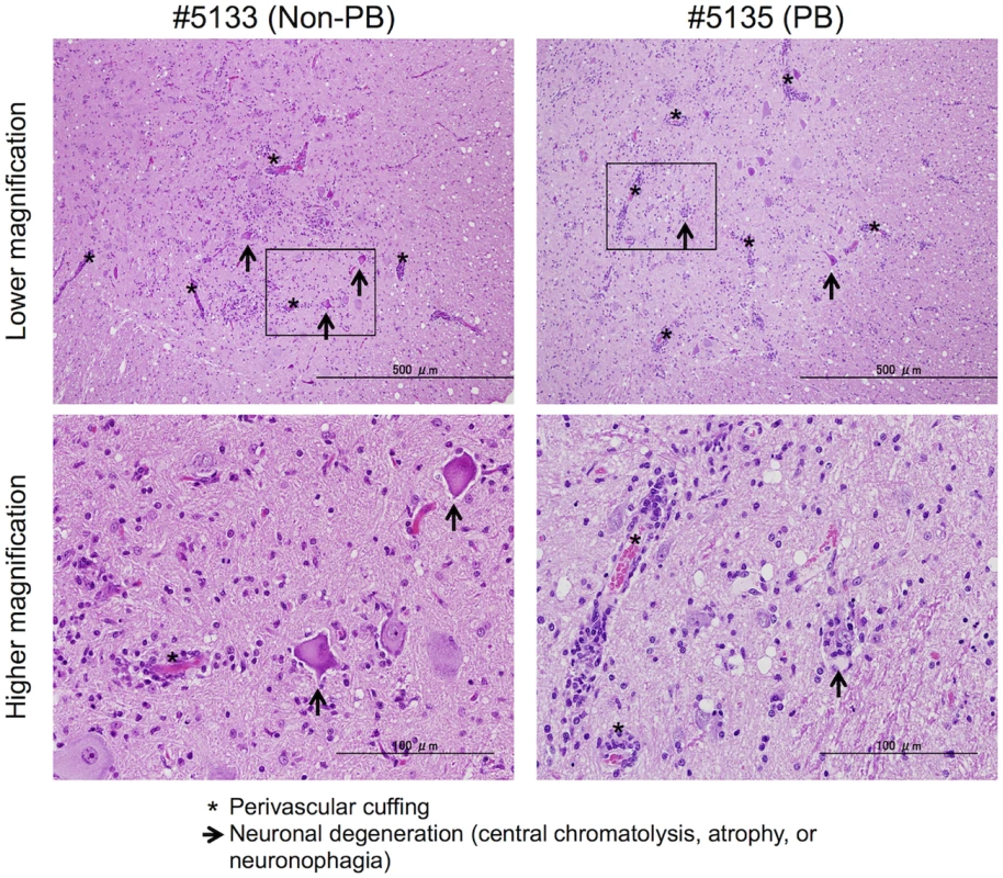 Histopathological spinal cord findings.