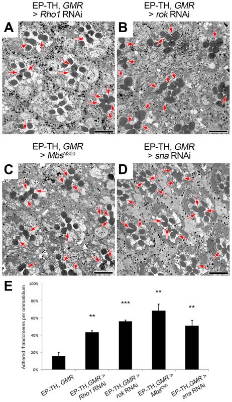 Regulators of Sqh are involved in retinal lumen formation.