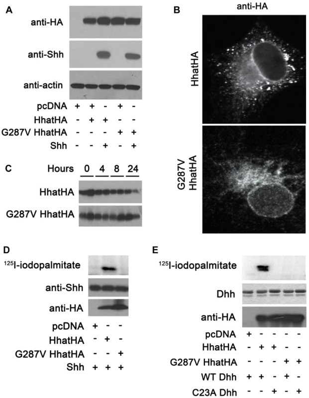 G287V mutation results in loss of HHAT activity.