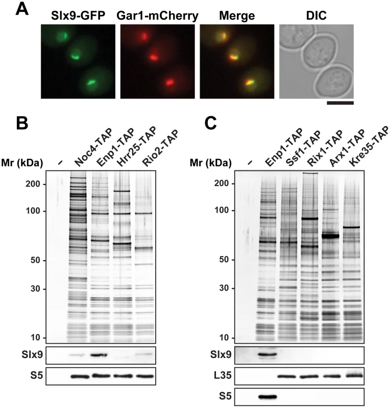 Slx9 associates with pre-ribosomal particles in the 40S maturation pathway.