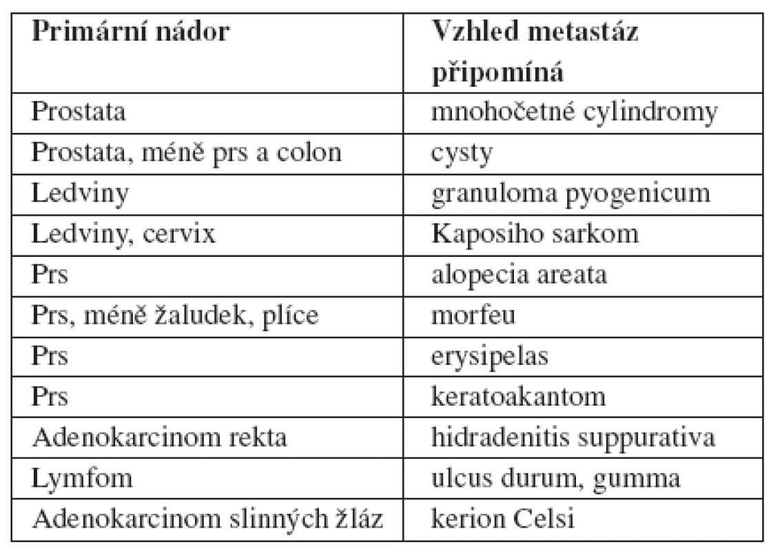 Kožní metastázy napodobující určitá onemocnění