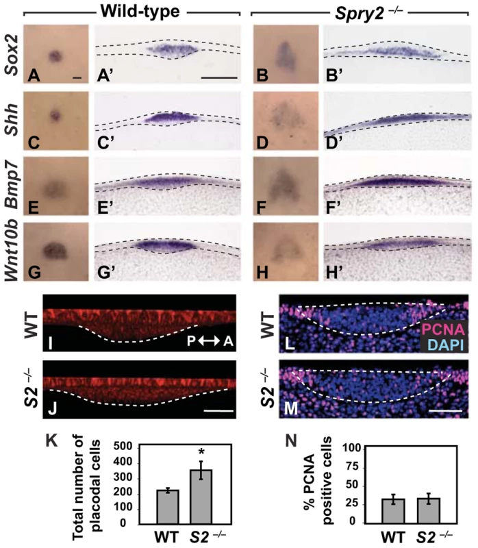 The CV progenitor field at E12.5 is expanded in <i>Spry2</i><sup>−/−</sup> mice.
