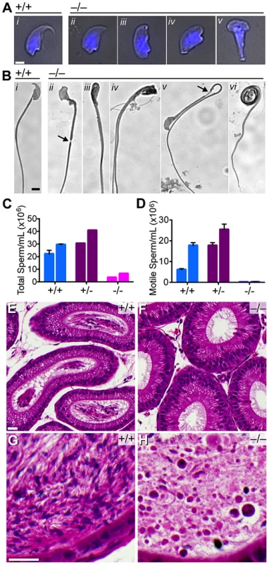 Quantitative and morphological defects of <i>Baz1a<sup>−/−</sup></i> sperm.