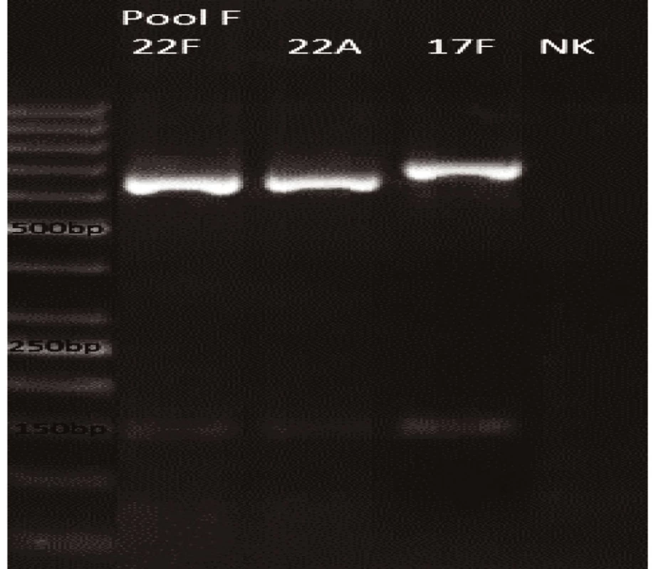 mPCR pool F
Dráha 1: 50bp DNA Ladder
Dráha 2: <i>S. pneumoniae</i> sérotyp 22F (643bp)
Dráha 3: <i>S. pneumoniae</i> sérotyp 22A (643bp)
Dráha 4: <i>S. pneumoniae</i> sérotyp 17F (693bp)
Dráha 5: negativní kontrola
Dráha 2–4: pozitivní produkt cpsA (160bp)<br>
Fig. 6. mPCR pool F
LLane 1: 50bp DNA Ladder
Lane 2: <i>S. pneumoniae</i> serotype 22F (643bp)
Lane 3: <i>S. pneumoniae</i> serotype 22A (643bp)
Lane 4: <i>S. pneumoniae</i> serotype 17F (693bp)
Lane 5: negative control
Lanes 2–4: positive product cpsA (160bp)