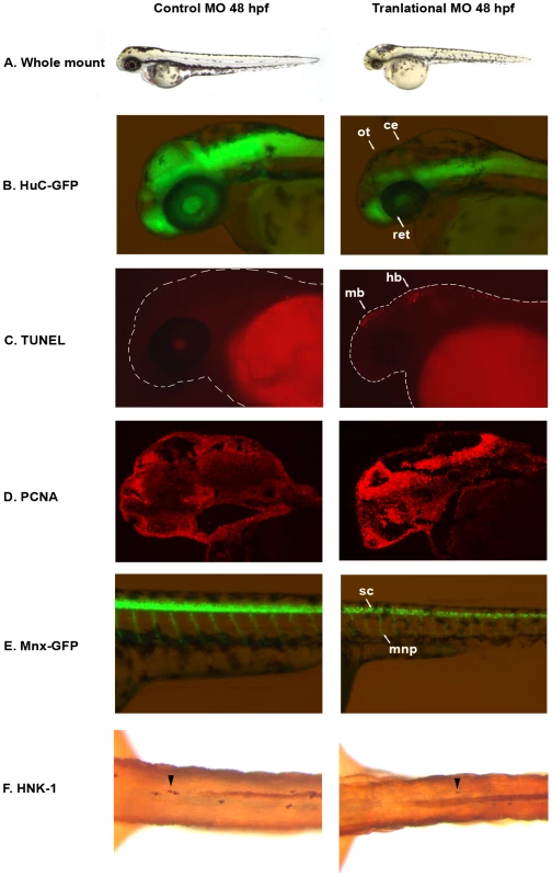 <i>auts2</i> 48 hpf morphant phenotype.
