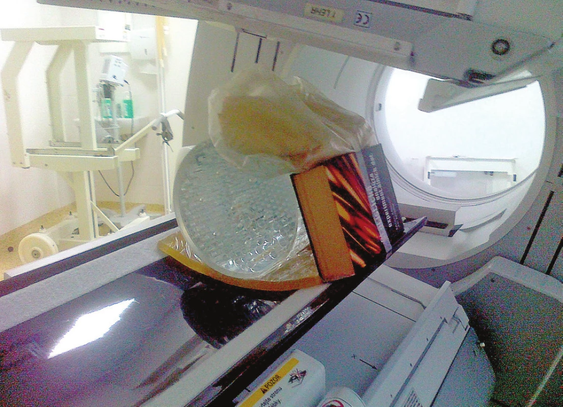 Příklady různých uspořádání objektů simulujících zvýšené zeslabení a rozptyl záření. Byly použity parafínové odlitky, vodě ekvivalentní balistický gel a kniha v různých kombinacích a uspořádáních.