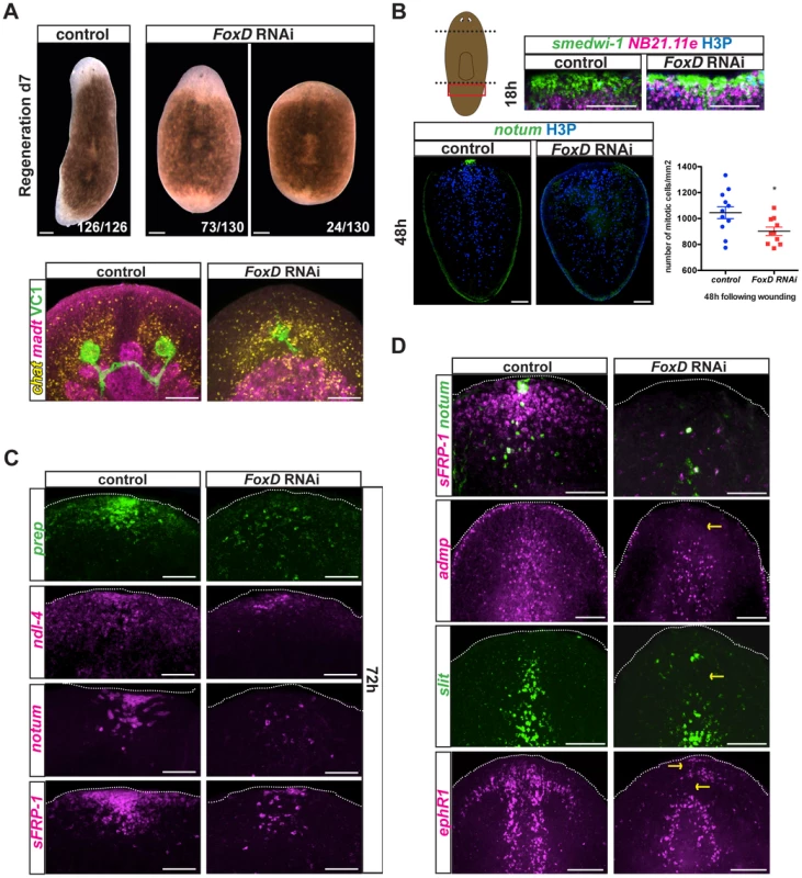 <i>FoxD(RNAi)</i> animals display abnormal anterior pole, head patterning and midline gene expression.