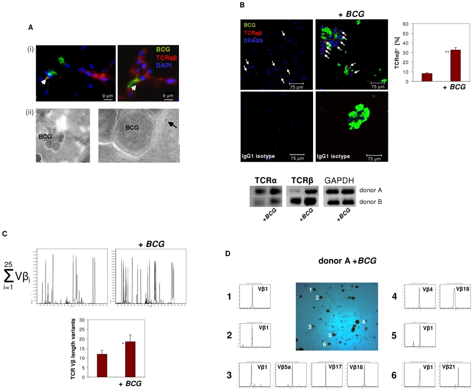 Infection of macrophages with <i>M. bovis BCG</i> induces TCRαβ expression <i>in vitro</i>.
