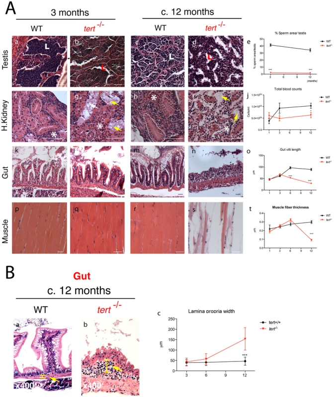 Telomerase depletion leads to a time- and tissue-dependent degeneration.
