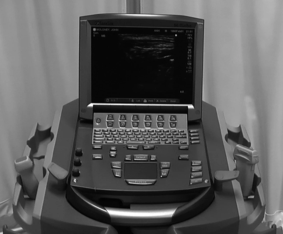 Přístroj Sonosite M-Turbo pro anestezii a intenzivní medicínu