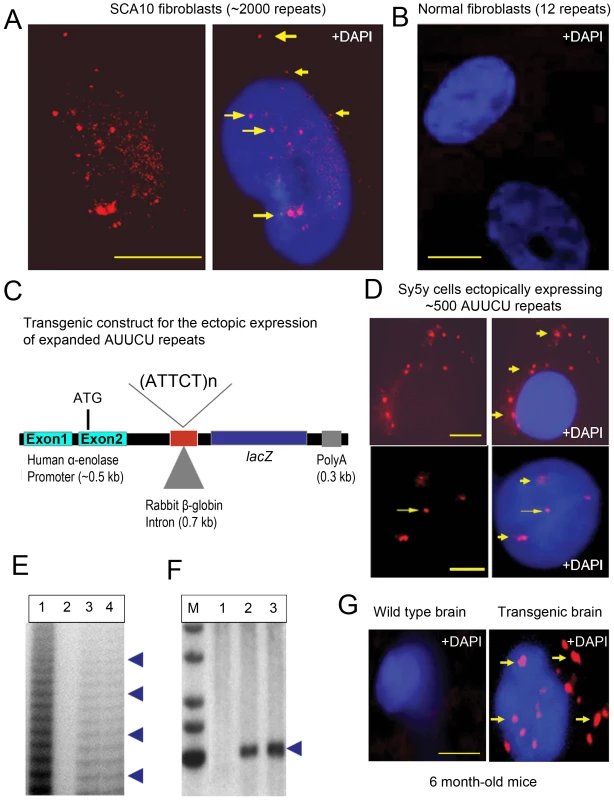 Expanded AUUCU transcripts form discrete aggregates.