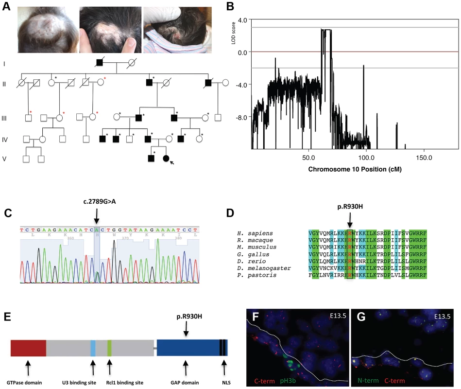 A mutation in the ribosome biogenesis GTPase BMS1 causes autosomal-dominant ACC.