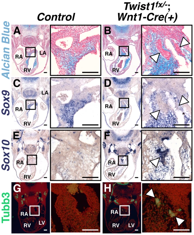 Abnormal NCCs in <i>Twist1</i>;<i>Wnt1-Cre</i> CKOs express neuronal, not mesenchymal, markers.