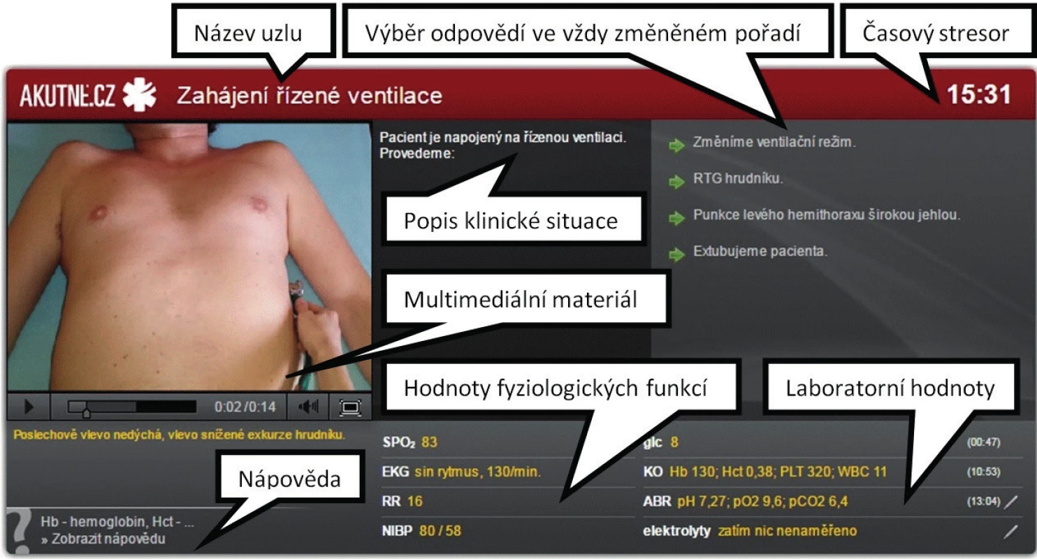 Popis uzlu interaktivního algoritmu