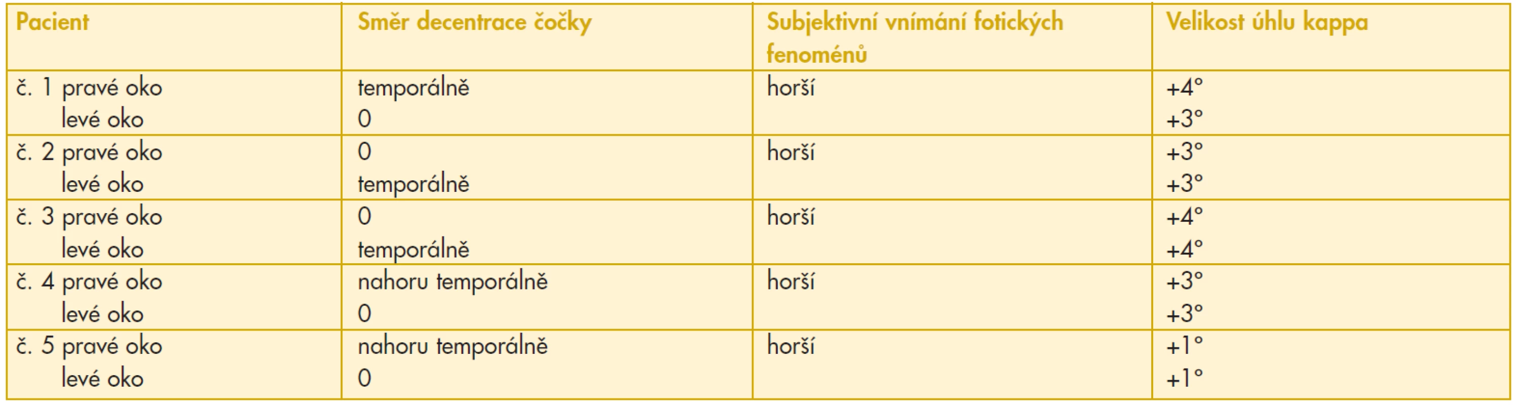 Údaje pacientů, kteří vnímali rozdílně fotické fenomény na pravém a levém oku ve vztahu k centraci čočky a velikosti úhlu kappa