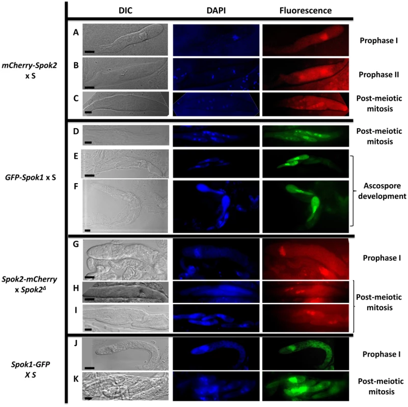 Localization of Spok protein in developing asci.