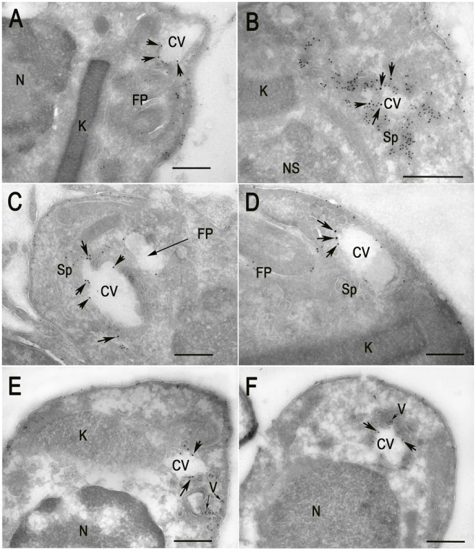 Cryo-immunoelectron microscopy localization of GFP-TcRab11 and TcTS in amastigotes.