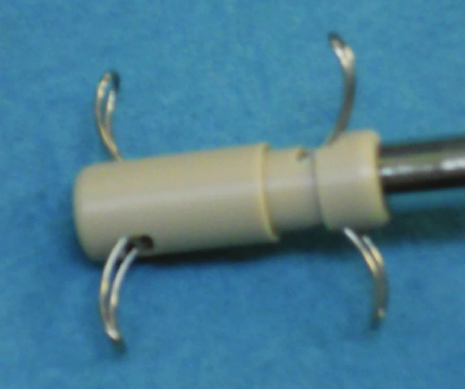 Interspinózní implantát In-Space, po stranách je opatřen čtyřmi vysouvatelnými titanovými křídly k trvalému zajištění pozice
Fig. 1: Interspinous implant In-Space, with four titanium side wings for the prevention of implant migration