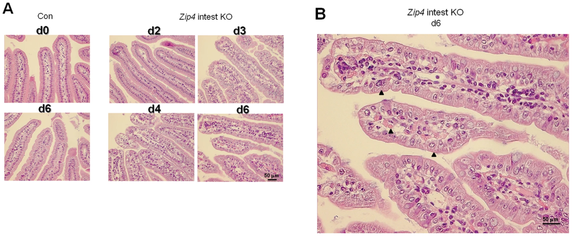 Progressive disruption of villus integrity after intestine-specific deletion of <i>Zip4</i>.