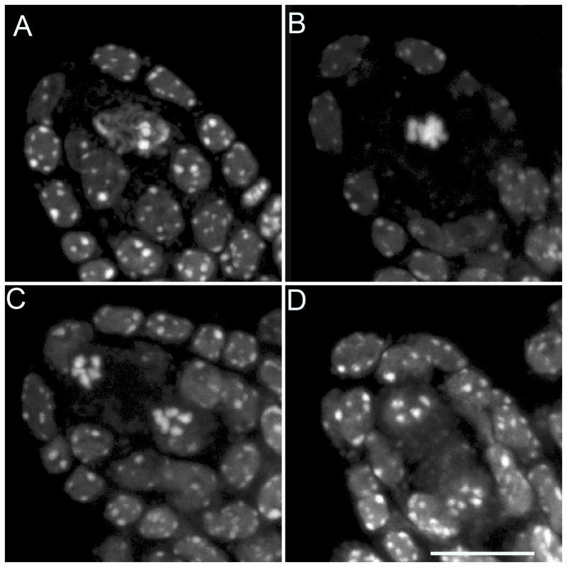 Female meiosis in the <i>tam-2/osd1-1</i> double mutant.