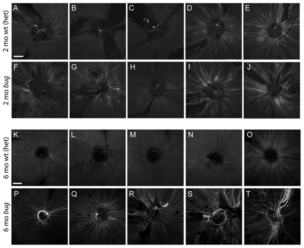 Expression of the <i>gap43</i>:GFP transgene in <i>lrp2</i> mutants.