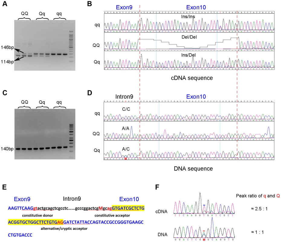 Identification of the g.8283C>A splice mutation in the <i>PHKG1</i> gene.