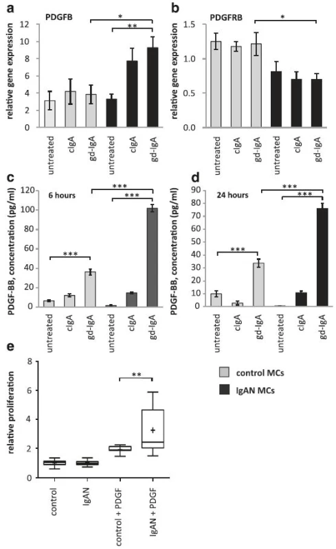 PDGF is the major growth factor for mesangial cells we therefore wanted to investigate the expression of PDGF in mesangial cells from controls or patients with IgA deposits as well as their response to stimulation with PDGF. Mesangial cells (MCs) from patients with IgA nephropathy (IgAN) and controls were stimulated with IgA1 purified from blood from healthy controls (cIgA) or patients with IgAN (gd-IgA) or medium only for 6 h and the gene expression was investigated. The gene expression of PDGFB was not affected for the control MCs when stimulated with either cIgA or gd-IgA. The gene expression of PDGFB was increased for the IgAN MCs when stimulated with either cIgA or gd-IgA and stimulation of gd-IgA on IgAN MCs had a significantly higher expression than in control MCs stimulated with gd-IgA (a). In contrast the gene expression of PDGFRB (gene coding for platelet-derived growth factor receptor beta) was lower in all samples from IgAN MCs compared to the control MCs, but the gene was not further affected by stimulation with either cIgA or gd-IgA (b). Medium was collected from IgAN MCs and control MCs after 6 and 24 h of stimulation with cIgA and gd-IgA and the release of PDGF-BB into the medium was measured. Both the IgAN MCs and control MCs released the highest amounts of PDGF-BB when stimulated with gd-IgA, but the levels was significantly higher for the IgAN MCs than for the control-MCs after 6 h (c) and 24 h (d). Mesangial cells from patients with IgAN and control were treated with 50 ng of either PDGF-AB or -BB or medium only and the relative proliferation of the cells was measured. Stimulation of the IgAN MCs with PDGF gave a significant increase of the relative proliferation compared to control MCs (e). <i>Grey bars</i> represent control MCs, <i>black bars</i> represent IgAN MCs *<i>P</i> < 0.05, **<i>P</i> < 0.01, **<i>P</i> < 0.001. Error bars in (a), (b), (c) and (d) represent SEM and in D min to max, + represents mean